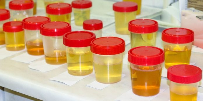Synthetic Urine for Science Research